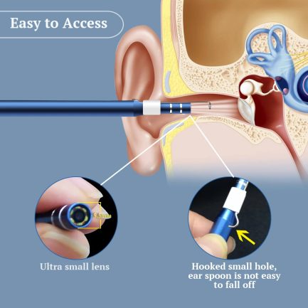 Otoscope de Nettoyage d’Oreille 3-en-1 Maroc